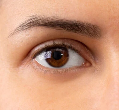 After using GLINT Eye Glow Serum for 3 weeks